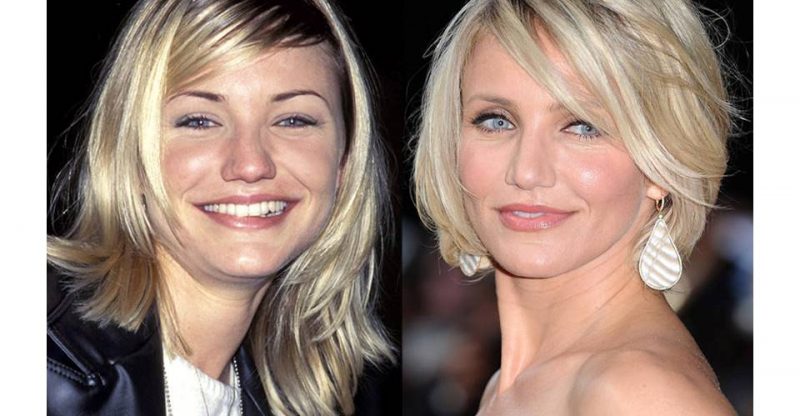 10 Celebs You Won’t Believe Underwent Plastic Surgery – ‘Then’ & ‘Now ...